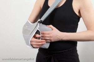 instabilità spalla - artrosi spalla - Dott Matthew Giordano